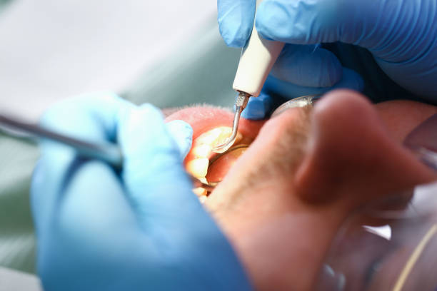 Emergency Gum Pain Relief in ME