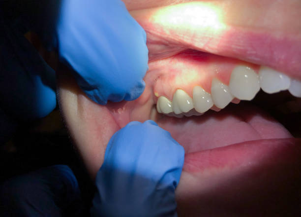 Best Emergency Gum Pain Relief  in Sanford, ME